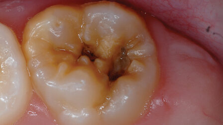 Trudent Dental Care Clinic